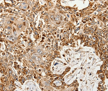 SLC9A7 Antibody
