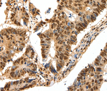SSB Antibody