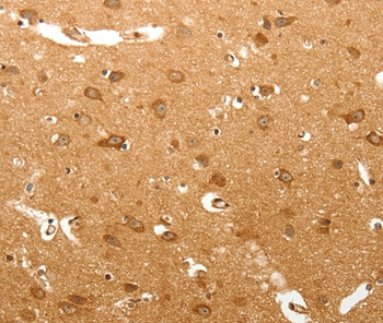 MAP1B Antibody