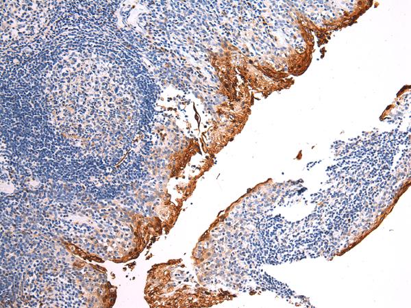 TENM3 Antibody