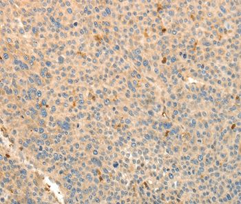 TMSB4X Antibody