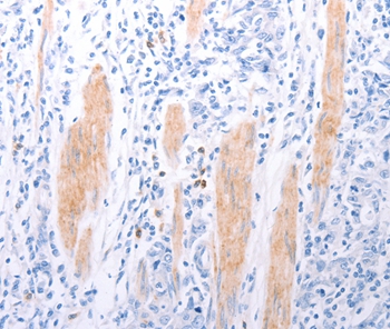 LPAR2 Antibody