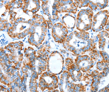 ALDH5A1 Antibody