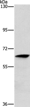 ALG6 Antibody