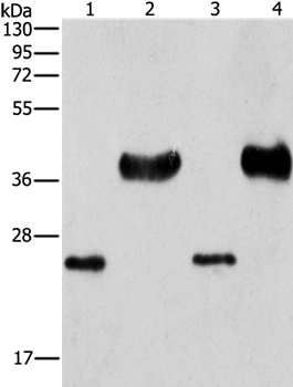 LIN28B Antibody