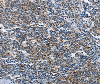 NEK1 Antibody