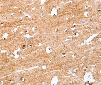 S100B Antibody