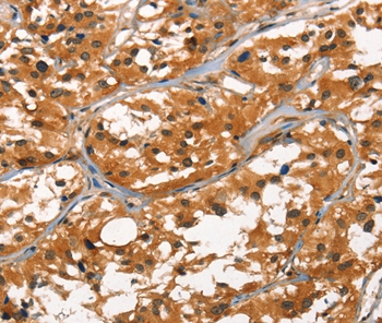 DEFA1/3 Antibody