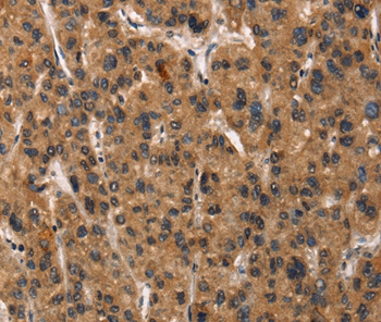 DEFA5 Antibody