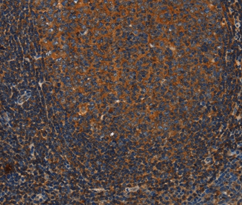 ANXA2R Antibody