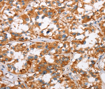 SLC4A1 Antibody