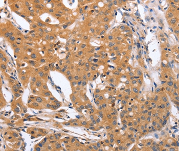 BLNK Antibody