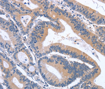 GDF11 Antibody