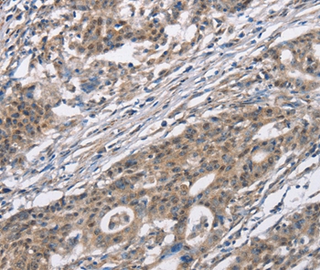 CACNA1 Antibody