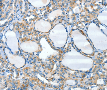 HID1 Antibody