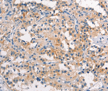 TDGF1 Antibody