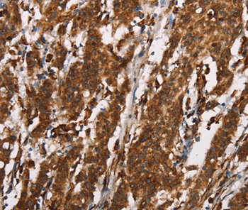 CTAG1A/B Antibody