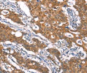 CYLD Antibody