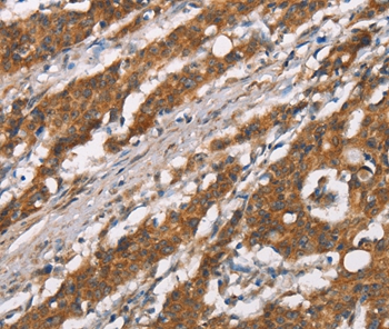DSC2 Antibody