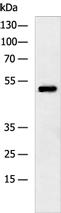 DGAT1 Antibody