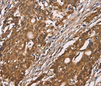DICER1 Antibody