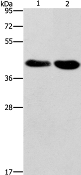 STK17A Antibody