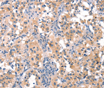 EIF4G1 Antibody