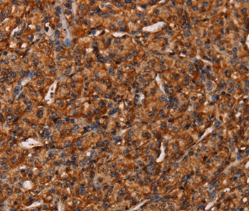 COL18A1 Antibody