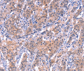 EP300 Antibody