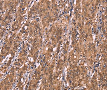 FBXO31 Antibody