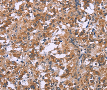 GNPAT Antibody