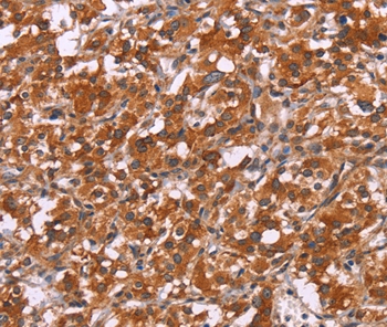 HSPB6 Antibody