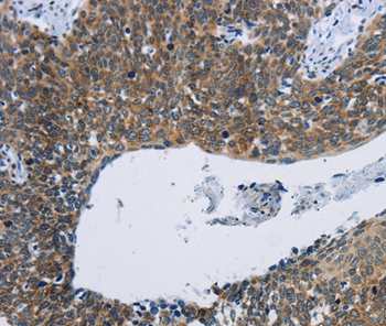 KPNB1 Antibody