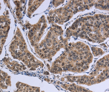 IPO8 Antibody