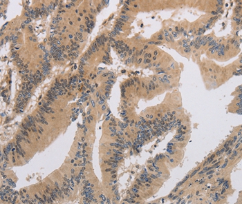 ITIH1 Antibody