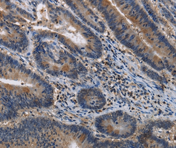 ITPR2 Antibody