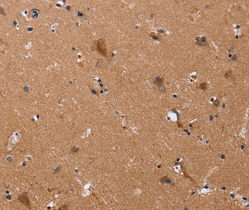 JAG1 Antibody