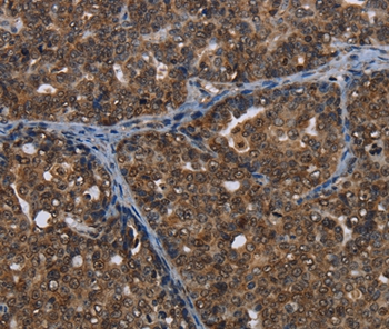 CERS6 Antibody