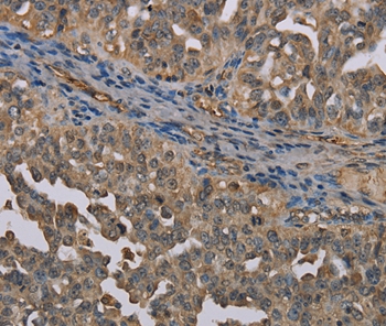UBP1 Antibody