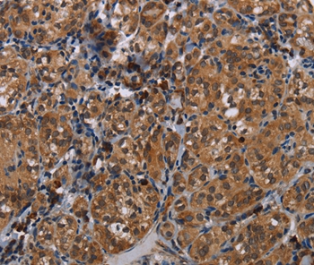 TRPV1 Antibody