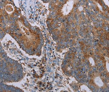 CYP7A1 Antibody