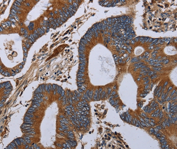 MT-ND6 Antibody