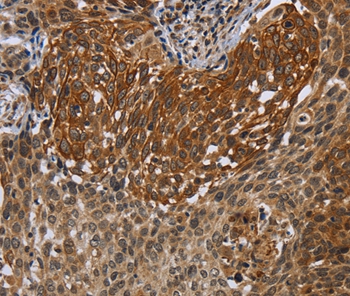 UHRF2 Antibody