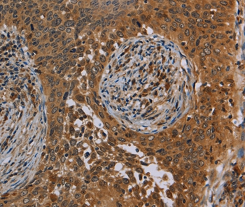 OSM Antibody