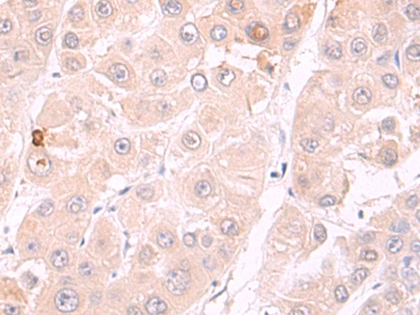 PARP8 Antibody