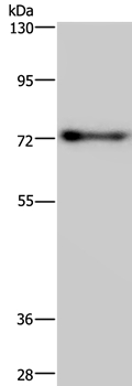 PATZ1 Antibody