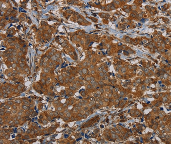 PIK3CD Antibody