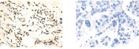 POU6F2 Antibody