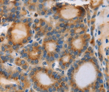 RIPK4 Antibody