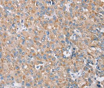 S100A9 Antibody
